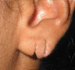 ear-lob