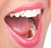 teeth-jewel